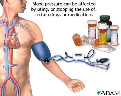 Diagnosis Of Hypertension