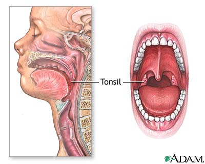 throat swollen and vomit