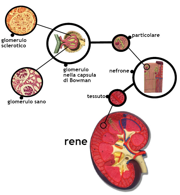 Nephrotic Syndrome Symptoms