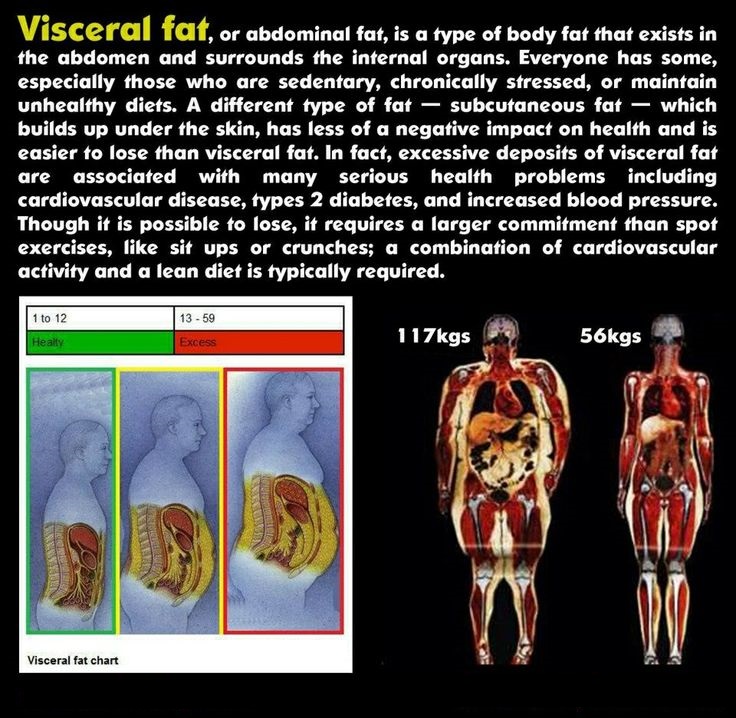 Obesity Weight Loss Homeopathic Treatment Medicine Remedies