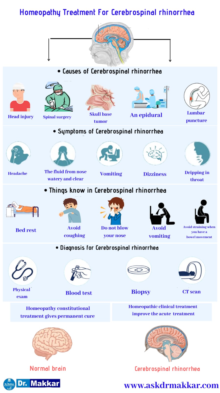Cerebrospinal Rhinorrhea, Nasal Fluid Brain, CSF Leakage, Causes, Symptoms, Diagnosis, Best Medicine
