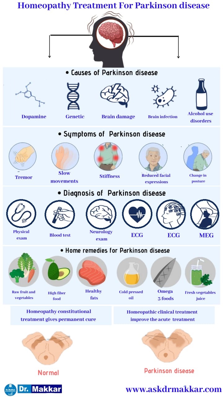 Best Homeopathic Treatment approach to Parkinson Disease || पार्किंसन डिजीज तंत्रिका तंत्र  का होम्योपैथिक इलाज  ट्रीटमेंट होम्योपैथिक दवाएं से इलाज