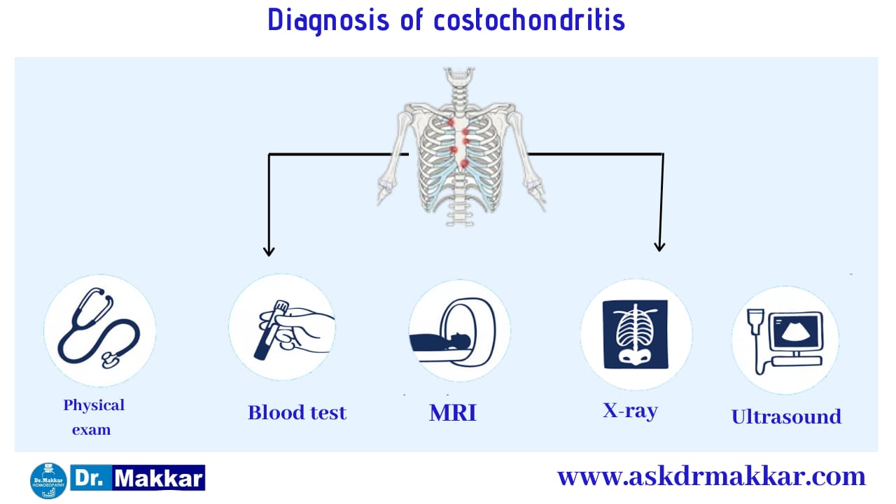 Diagnosis and investigations for Costochondritis Pain in Ribs || कोस्टोकोंडाइटिस पसली में सूजन की मूल्यांकन  जाँच पड़ताल
