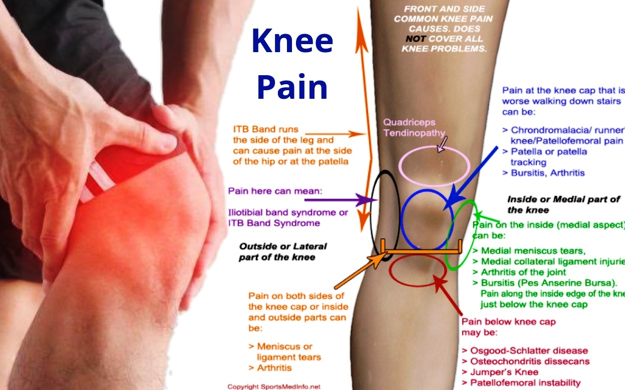 lower knee cap pain