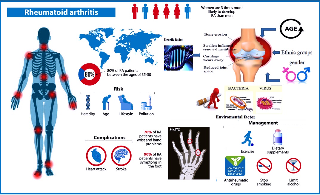 Rheumatoid Arthritis Online Homeopathic Treatment Offers Arthritis Pain 