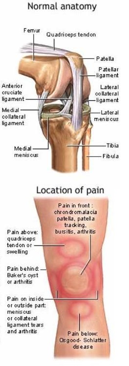 Knee pain Homeopathic Treatment